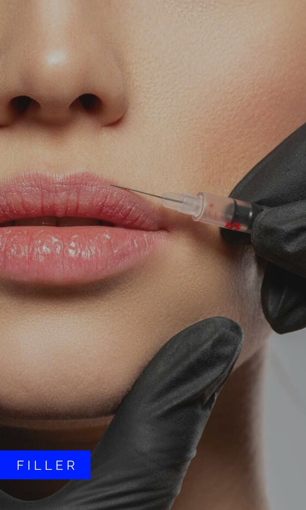 Dermal Fillers