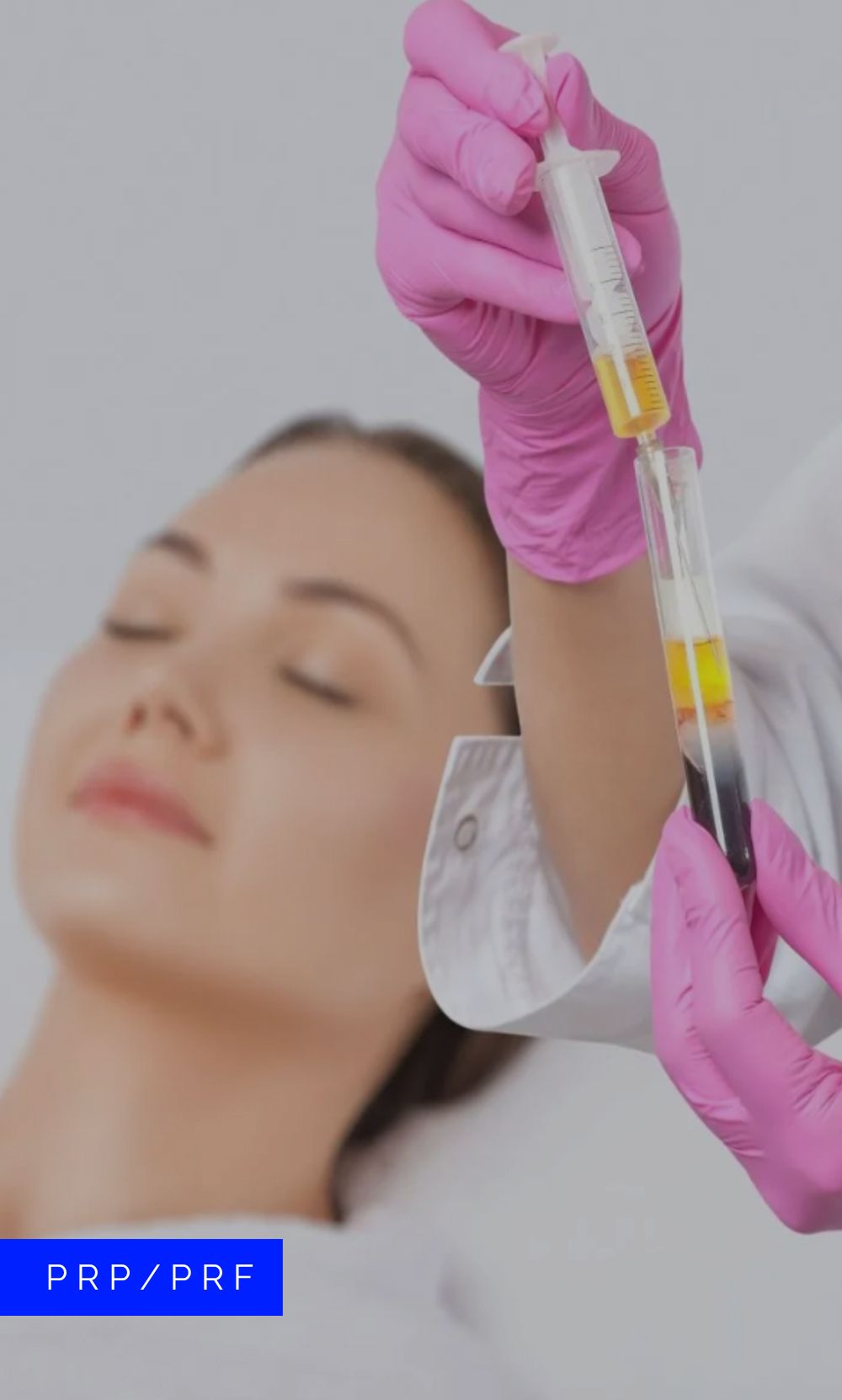 PRP Therapy